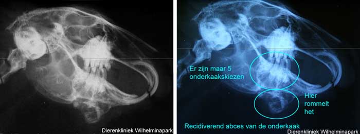 Kieswortelrest in beeld gebracht met rontgenfoto